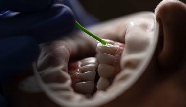 Diplomado Clínico en Odontología Estética Restauradora
