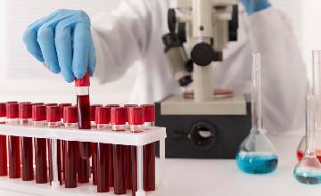 Diplomado en Hemodinamia, Angiografía y Terapia Guiada por Imágenes